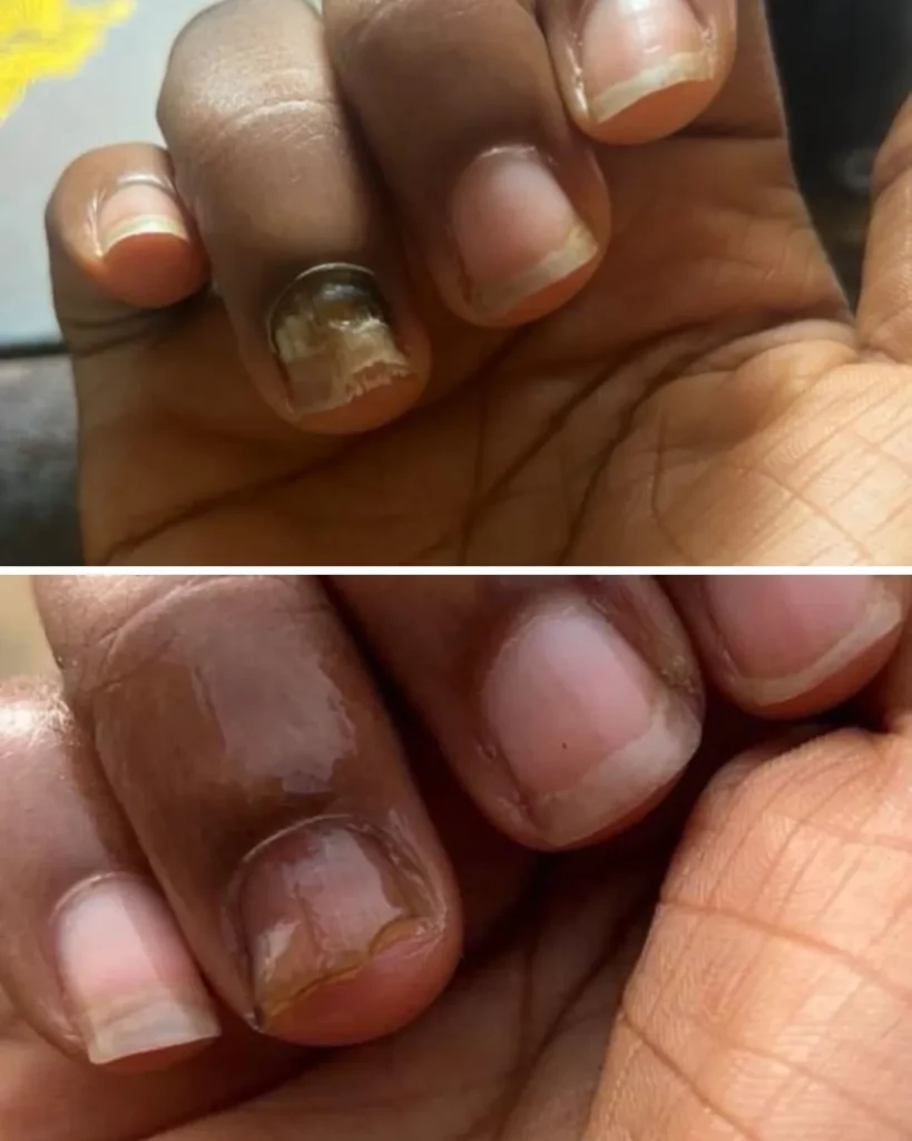 Discolored Nails Treatment Products in Nigeria
