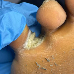 DERMA FIXIT